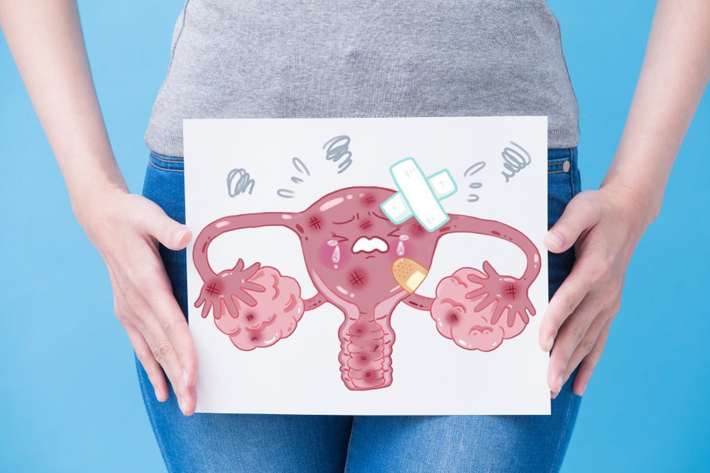 Cervix Cancer: Symptoms, Causes, Stages & Treatment