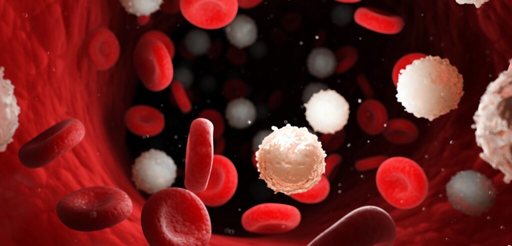 Leukemia: Simptom, Gejala, Penyebab, Rawatan