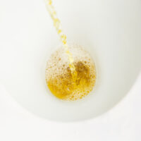 【蛋白尿】小便有泡是健康警号？了解原因、治疗和饮食建议