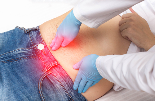 【小肠气】拆解原因、症状及治疗方法